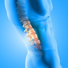 Severe Back Pain